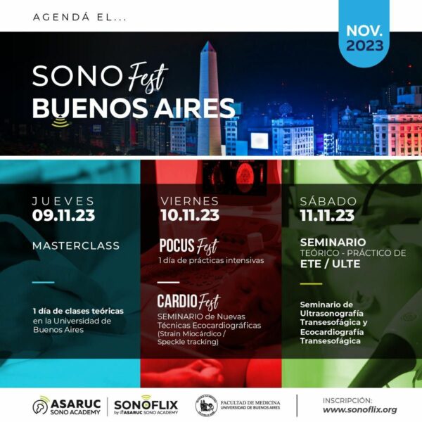 Seminario expertos: VExUS (Francisco Miralles Aguiar)